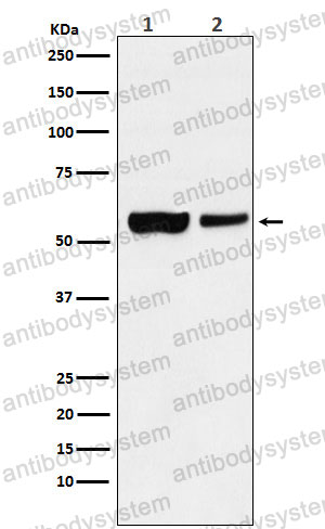 Anti-USP22 Antibody (R2N01)