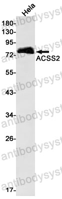 Anti-ACSS2 Antibody (R2N04)