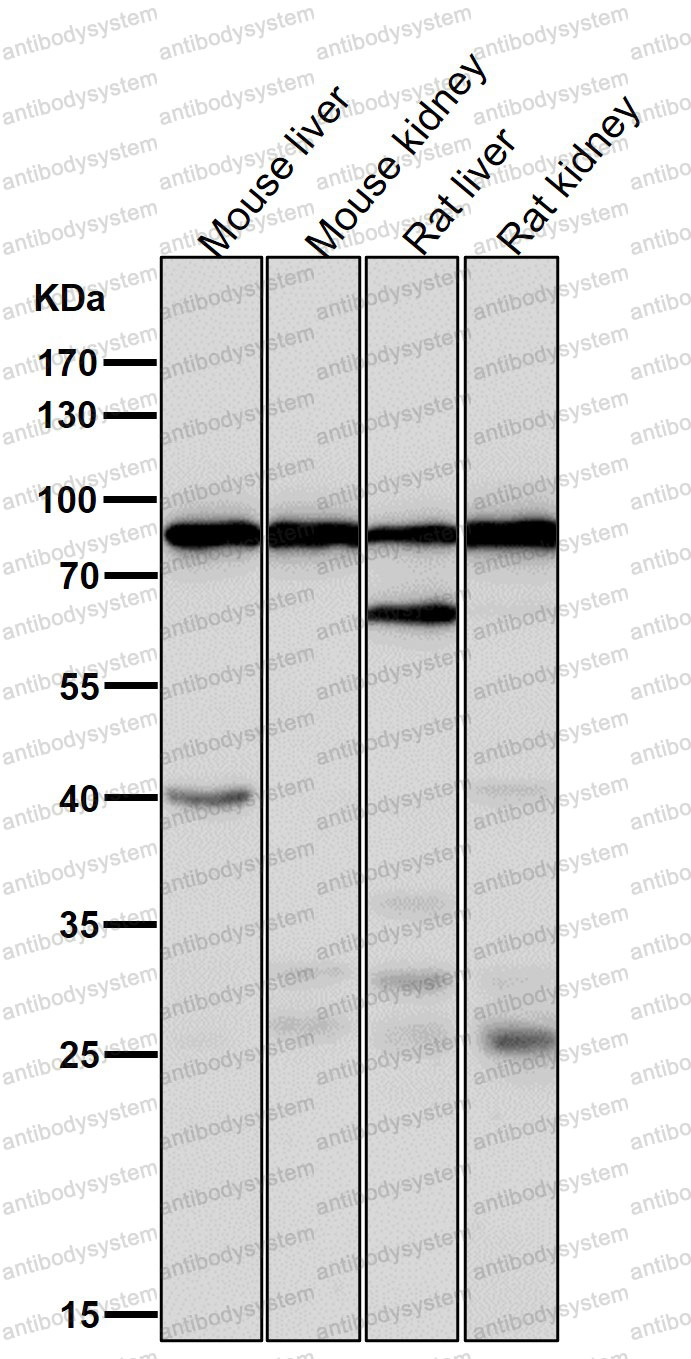 Anti-ACSS2 Antibody (R2N03)