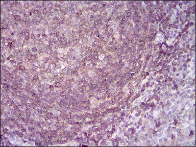Immunohistochemical for Anti-APBB1IP Antibody (R3Z39) ?>