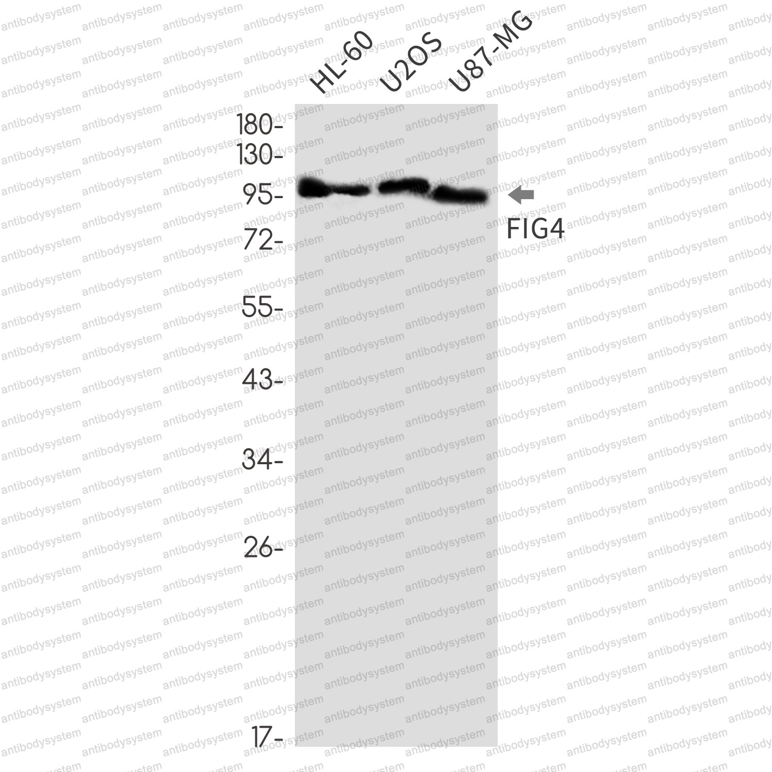 Anti-FIG4/SAC3 Antibody (R2N14)
