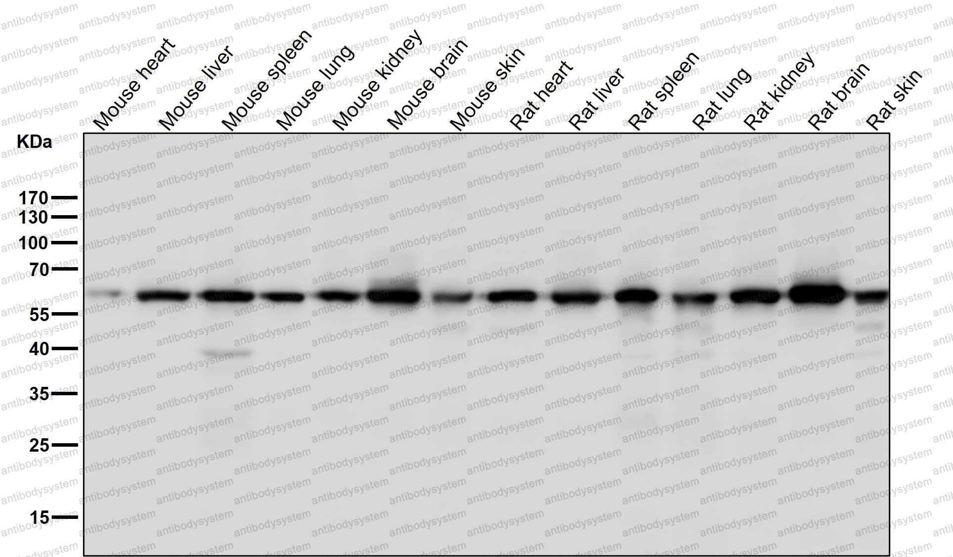 Anti-ELP3 Antibody (R2N15)