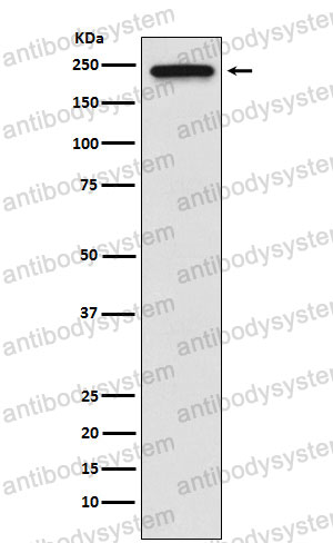 Anti-TRPM7/LTRPC7 Antibody (R2N16)
