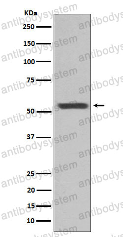 Anti-KRT12 Antibody (R2N29)