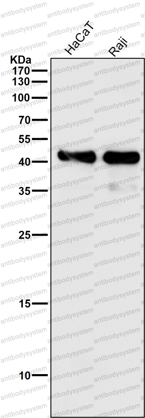 Western blot for Anti-HLA-A Antibody (R2N34) ?>