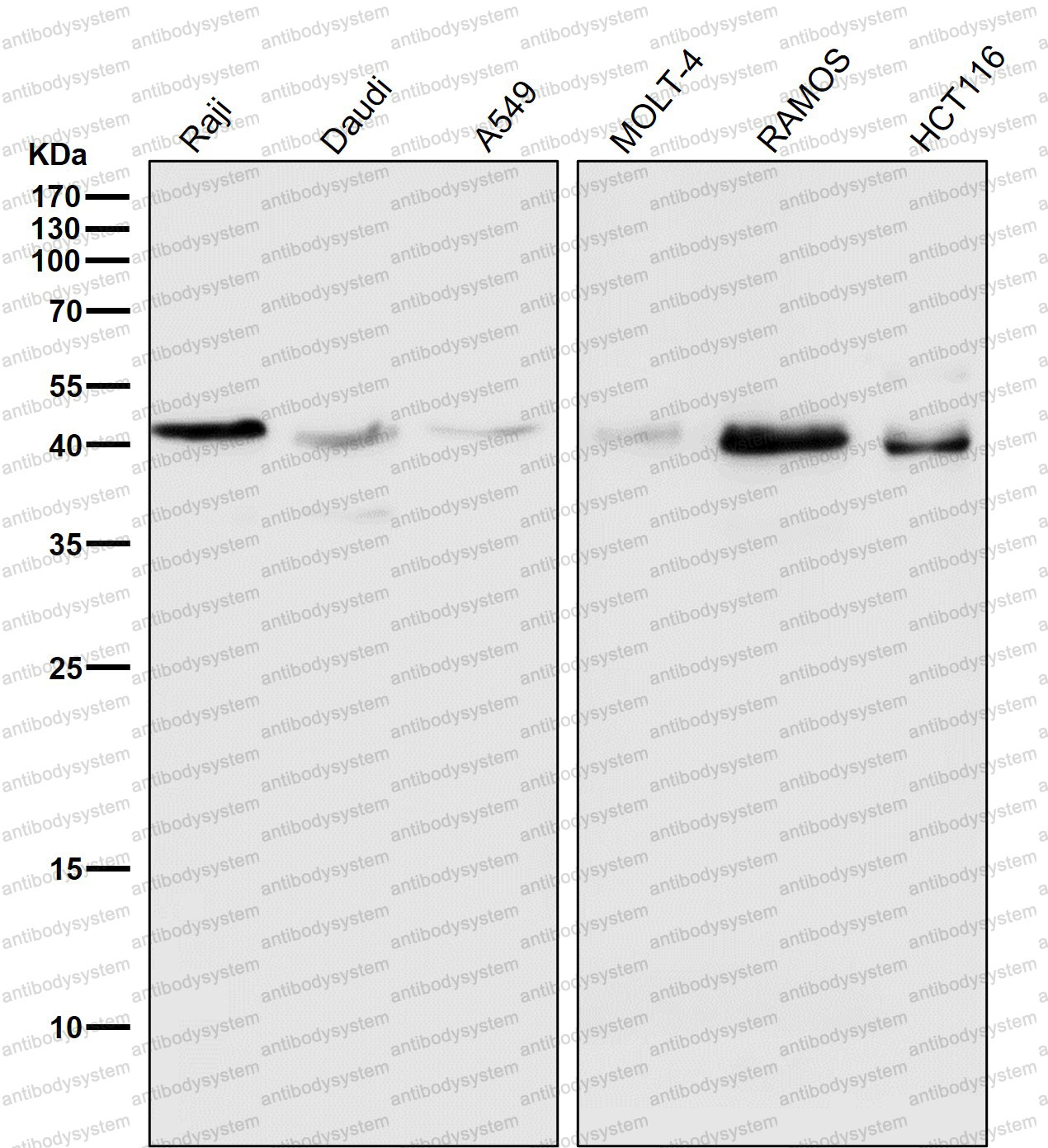 Western blot for Anti-HLA-A Antibody (R2N34) ?>