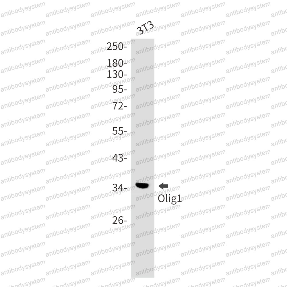 Anti-OLIG1 Antibody (R2N54)