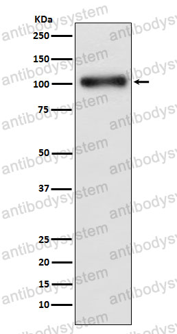 Anti-GABBR1 Antibody (R2N61)