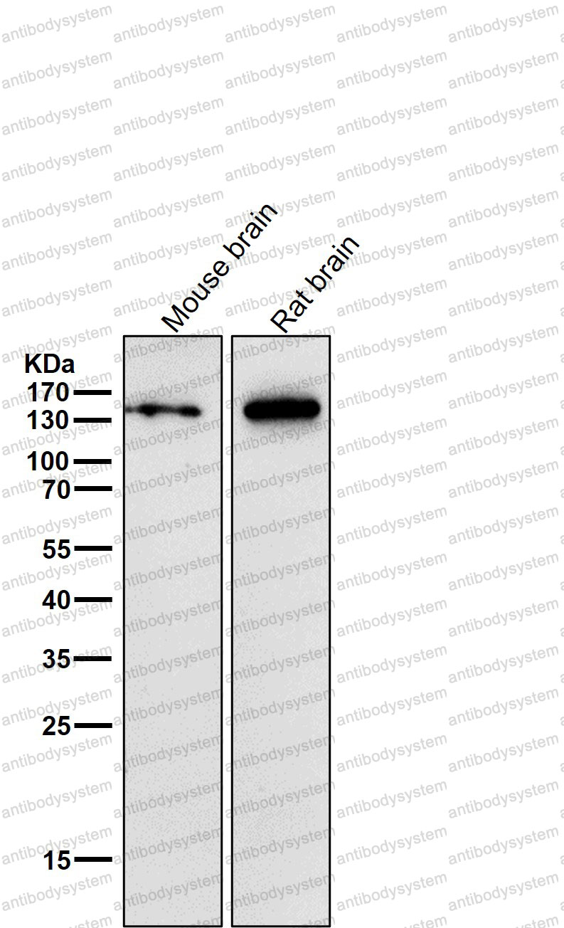 Anti-CASPR2/CNTNAP2 Antibody (R2N62)