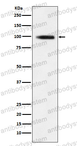 Anti-GIT1 Antibody (R2N63)