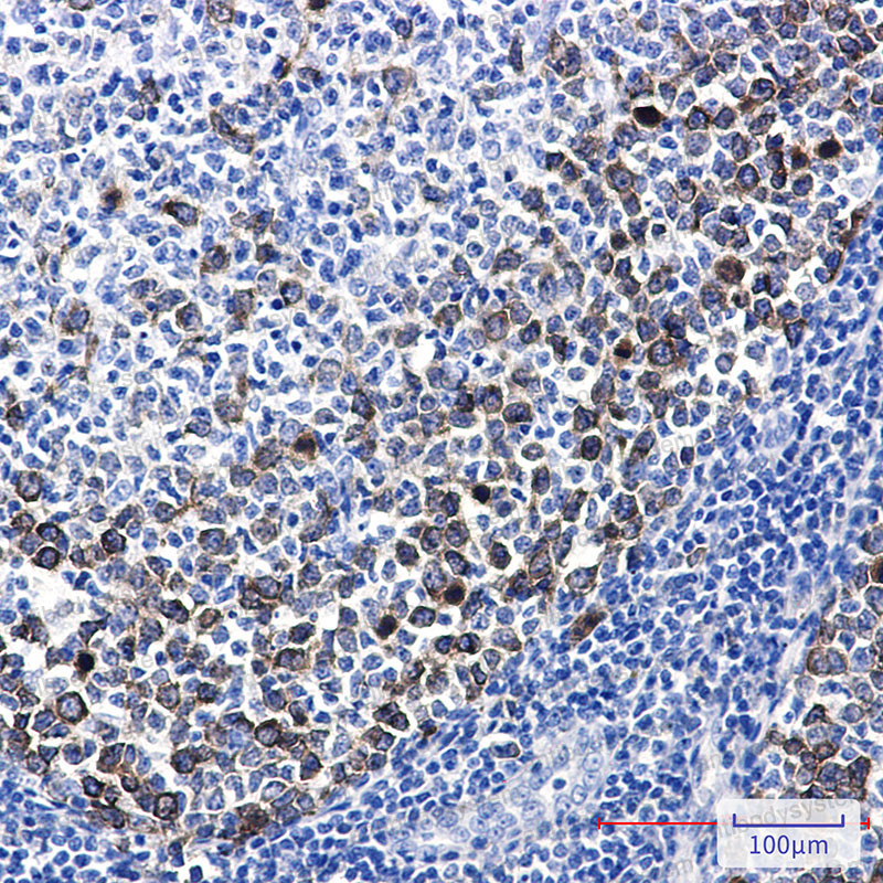 Anti-TACC3 Antibody (R2N64)