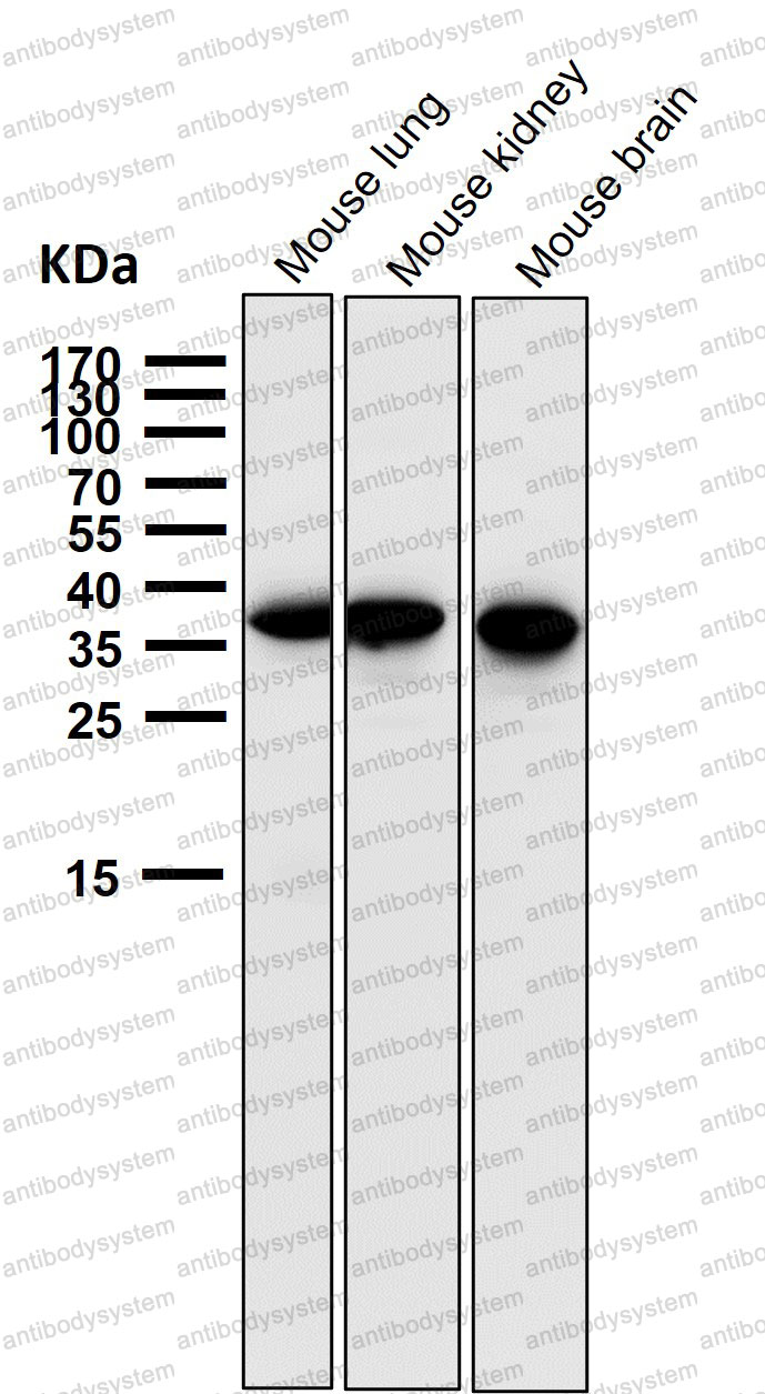 Anti-GGH Antibody (R2N65)