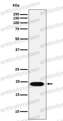 Anti-MSRB3 Antibody (R2N66)