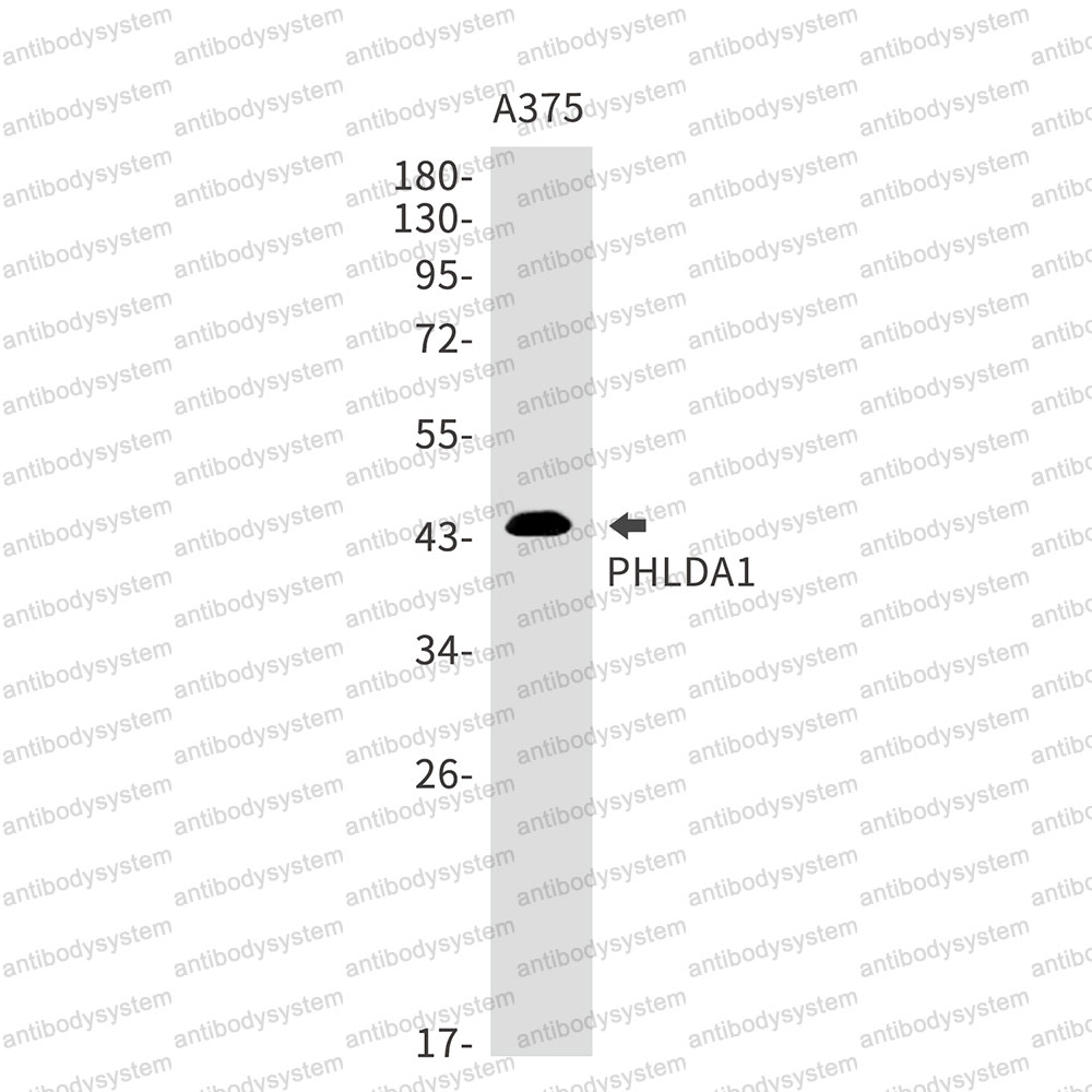 Anti-PHLDA1 Antibody (R2N68)