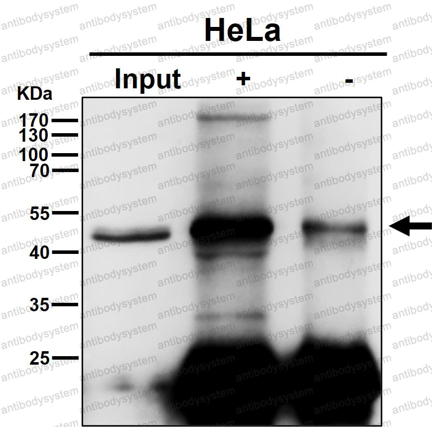 Anti-CELF1 Antibody (R2N69)