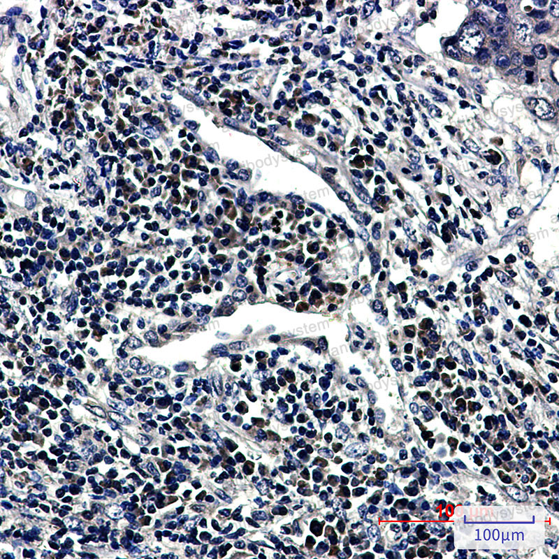 Anti-RNF2 Antibody (R2N72)