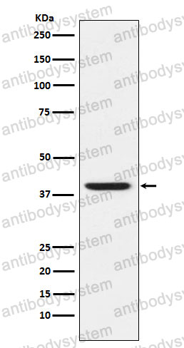Anti-RING2/RING1B/RNF2 Antibody (R2N71)