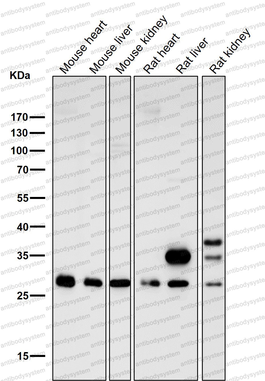 Anti-CDCA3 Antibody (R2N73)