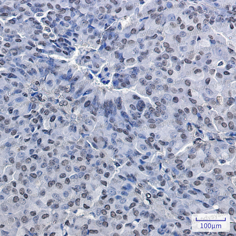 Anti-PRMT1 Antibody (R2N75)