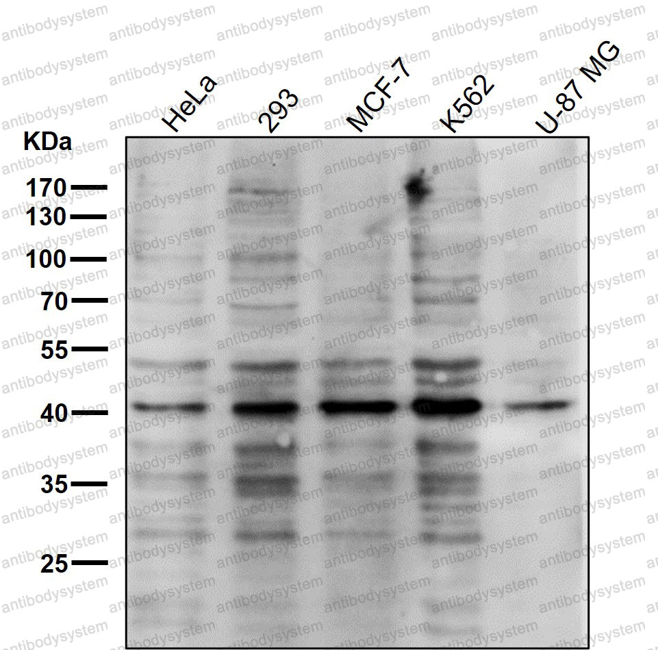 Anti-PRMT1 Antibody (R2N74)