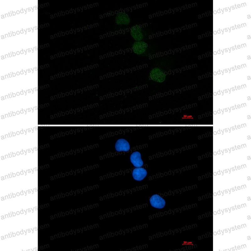 Anti-SAE1 Antibody (R2N77)