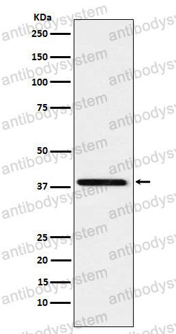 Anti-SAE1 Antibody (R2N76)