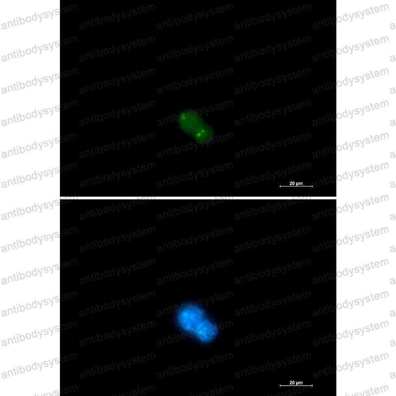 Anti-UBA2/SAE2 Antibody (R2N79)
