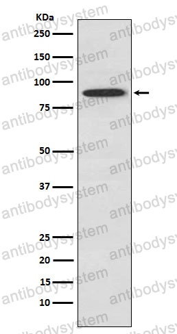 Anti-UBA2/SAE2 Antibody (R2N78)