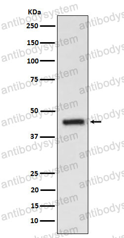 Anti-S1PR3 Antibody (R2N81)
