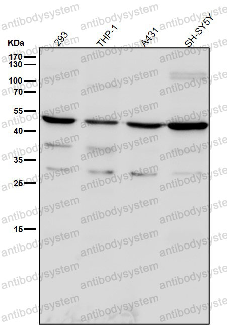 Anti-TNFRSF19 Antibody (R2N82)