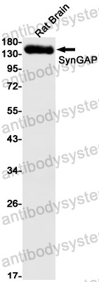 Anti-SYNGAP1 Antibody (R2N84)