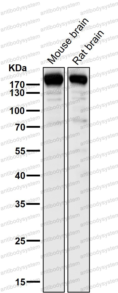 Anti-SYNGAP1 Antibody (R2N83)