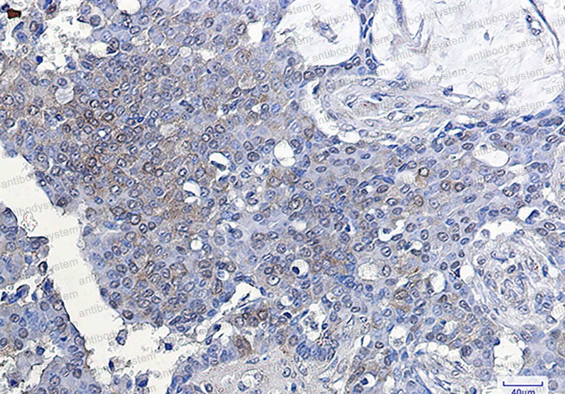 Anti-ATF5 Antibody (R2N86)