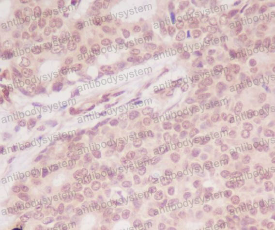 Anti-ATF5 Antibody (R2N85)