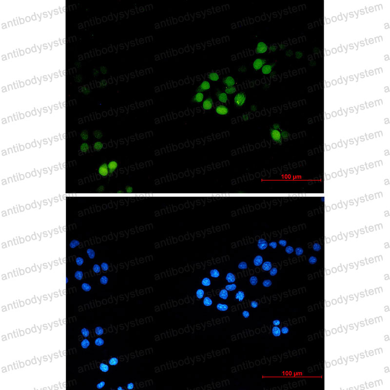 Anti-TPX2 Antibody (R2N88)