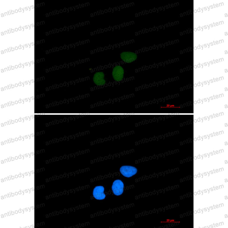 Anti-TPX2 Antibody (R2N87)