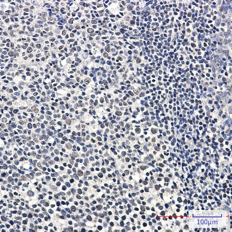Anti-IKZF3 Antibody (R2N91)