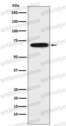 Anti-IKZF3 Antibody (R2N89)