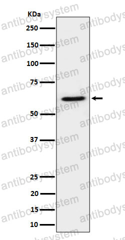 Anti-IKZF3 Antibody (R2N90)