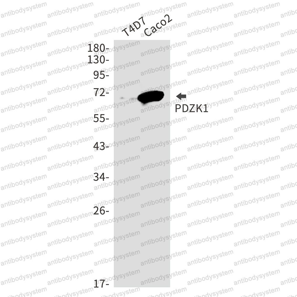 Anti-NHERF-3/PDZK1 Antibody (R2N93)