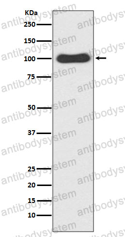 Anti-CDC5L Antibody (R2N94)