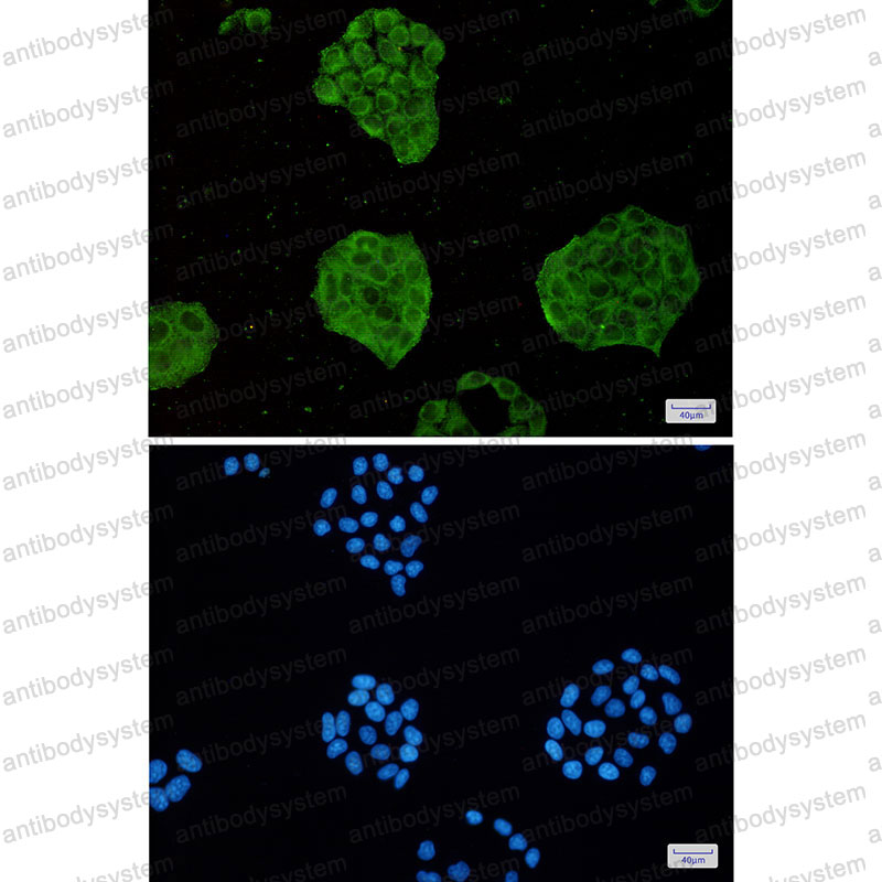 Anti-TRIM56 Antibody (R2N95)