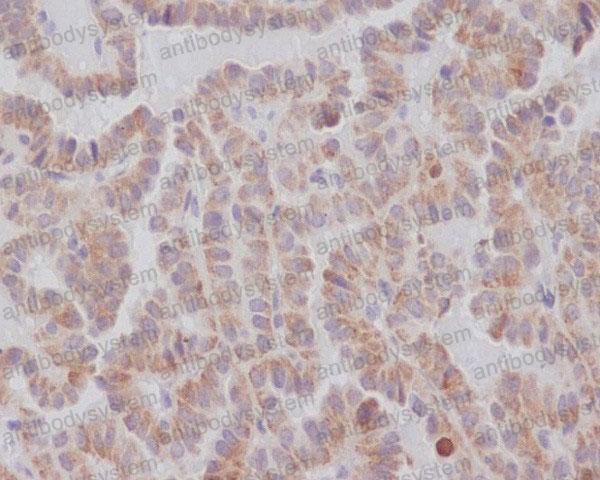 Anti-KIFC1 Antibody (R1A12)