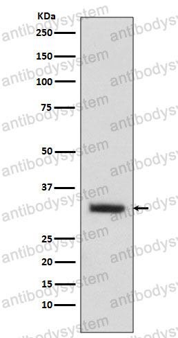 Anti-ENKUR/C10orf63 Antibody (R1A31)