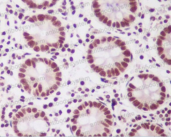 Anti-PTBP2 Antibody (R1A34)