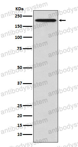 Anti-EIF2AK4 Antibody (R2P01)