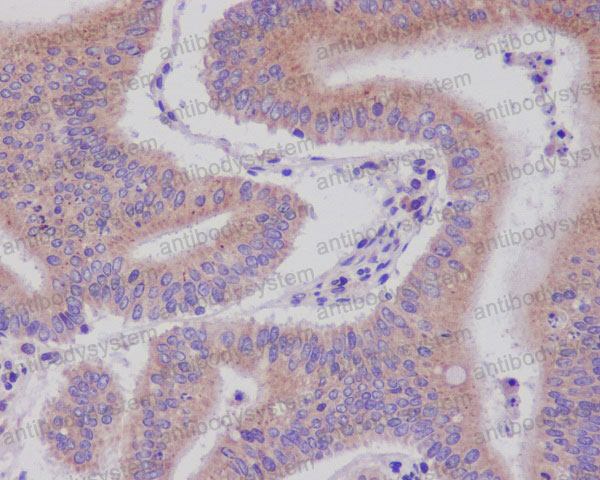 Anti-DNAJC15 Antibody (R1B24)