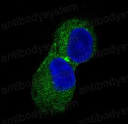 Anti-CAMK2A Antibody (R1B32)