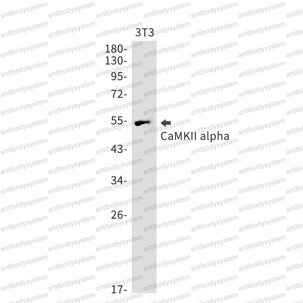 Anti-CAMK2A Antibody (R2P06)