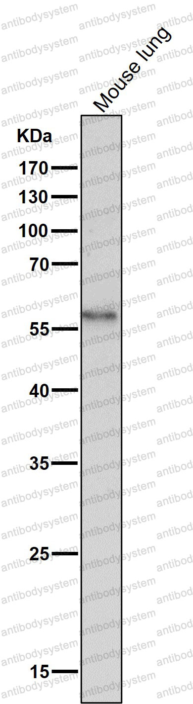 Anti-CaMKII Antibody (R2P03)